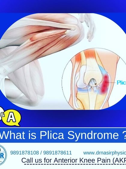 This Q&A explains Plica Syndrome, a common cause of anterior knee pain. We provide effective conservative treatment for this condition by focusing on pain management, mobility, and strengthening exercises.