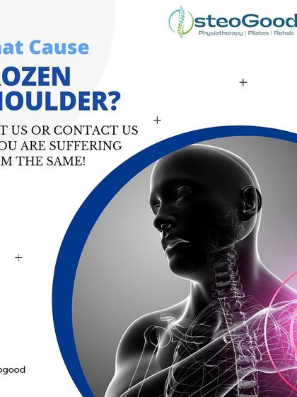 If you are experiencing stiffness and pain in your shoulder, it could be a frozen shoulder. This condition often develops after a period of immobility. I can help with targeted exercises to regain movement and reduce pain.