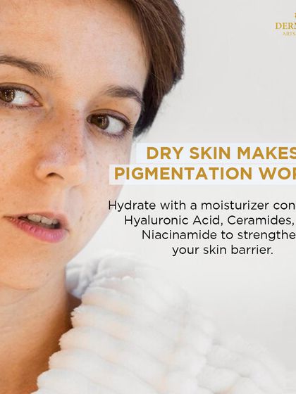Dry skin makes pigmentation worse. This image advises hydrating with a moisturizer containing Hyaluronic Acid, Ceramides, and Niacinamide to strengthen the skin barrier.