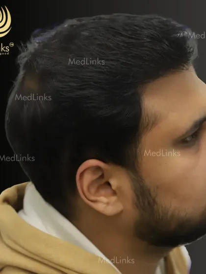 A different angle of the final result, showing the consistent density and natural look from all sides.