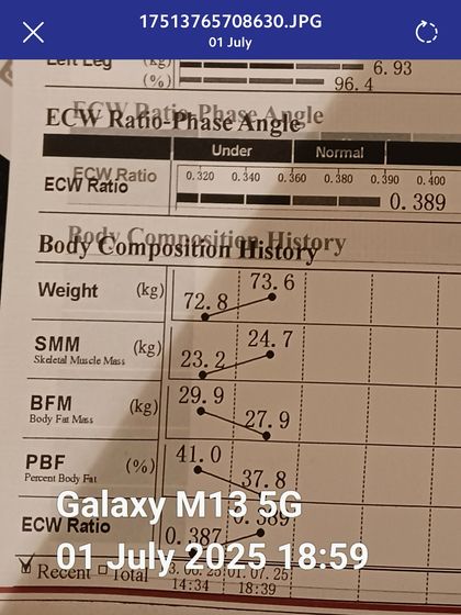 The same patient's progress tracked over time. The upward trend in skeletal muscle mass and the downward trend in body fat mass demonstrate the success of our medically guided Tirzepatide and Wonder Prestige program.