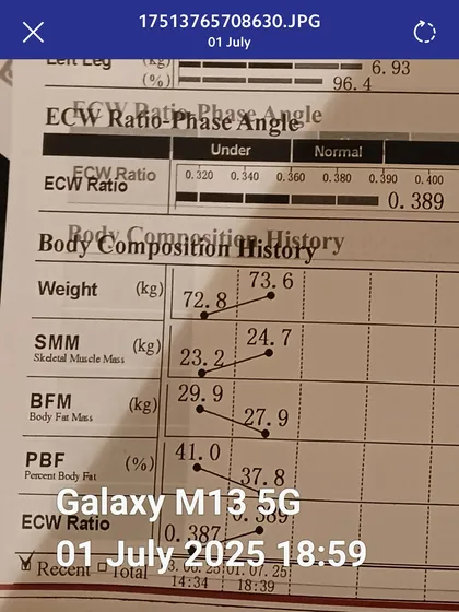 The same patient's progress tracked over time. The upward trend in skeletal muscle mass and the downward trend in body fat mass demonstrate the success of our medically guided Tirzepatide and Wonder Prestige program.