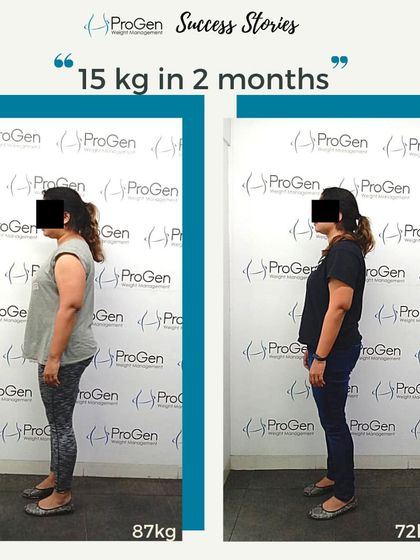 A side-profile view of the 15 kg transformation in two months. This angle clearly shows the reduction in abdominal fat and improved posture.