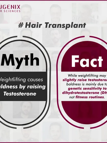 A series of graphics debunking common myths about fitness and hair loss, such as whether exercise, sweating, or high-protein diets cause baldness.