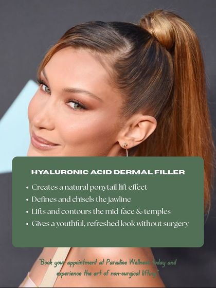 The "ponytail lift" effect can be created with hyaluronic acid dermal fillers. By strategically adding volume to the temples and mid-face, I can create a lifted, youthful look without surgery.