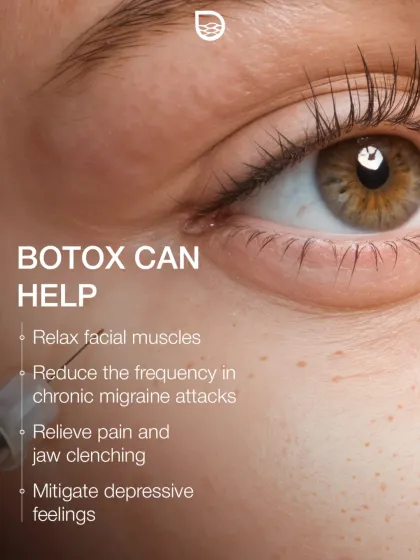 Beyond aesthetics, Botox has therapeutic benefits. I use it to help relax facial muscles, which can relieve pain from jaw clenching and even reduce the frequency of chronic migraine attacks.