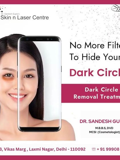 No more filters to hide your dark circles. This ad promotes my dark circle removal treatments, designed to give you refreshed, rejuvenated eyes and boost your confidence.