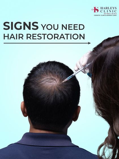 This graphic illustrates one of the key signs you may need hair restoration: visible thinning at the crown, a common concern for many men. We offer solutions like PRP and FUE transplant.
