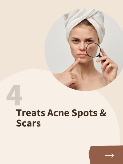 Clinic Next Face - Advanced Skin Treatments Natural Rejuvenation: PRF & PlasmoDerm photo 25