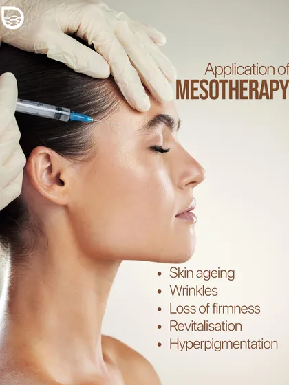 Mesotherapy is a versatile treatment for skin aging, wrinkles, loss of firmness, and hyperpigmentation. Here, the solution is being applied to revitalize the skin.