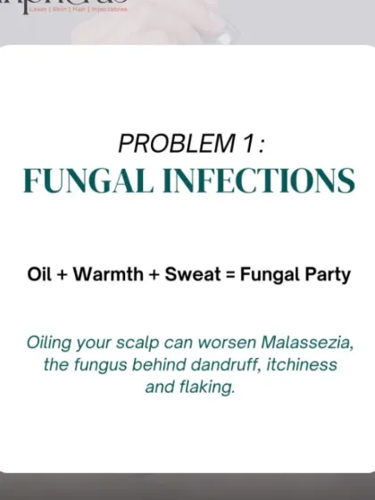 This post explains how a combination of oil, warmth, and sweat can create an environment for fungal growth, leading to conditions like Malassezia, which causes dandruff and itchiness.