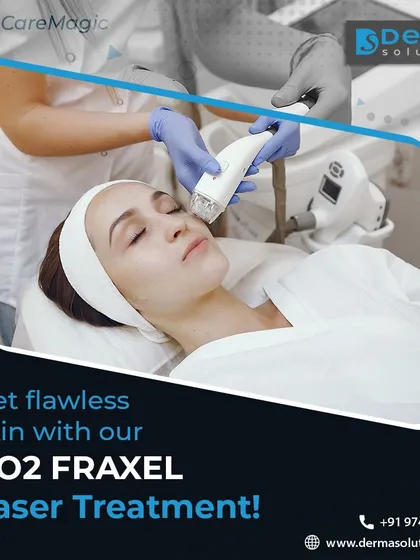 For deeper scars and significant texture issues, I often recommend the CO2 Fraxel laser. This treatment effectively resurfaces the skin to promote new, healthy tissue growth with minimal downtime.