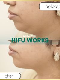 Cosmetic Injectables & Anti-Aging