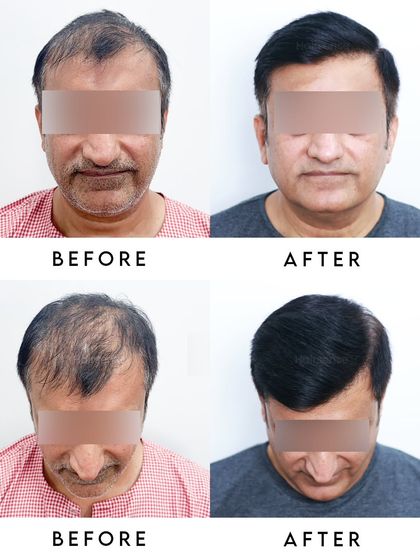 A multi-angle collage providing a complete 360-degree view of the incredible transformation, showing both frontal and top-down results.