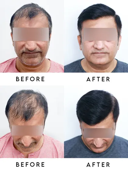 A multi-angle collage providing a complete 360-degree view of the incredible transformation, showing both frontal and top-down results.
