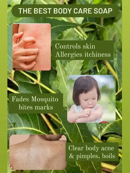 This soap is my go-to solution for body care. It helps control skin allergies and itchiness, fades mosquito bite marks, and clears body acne and boils.