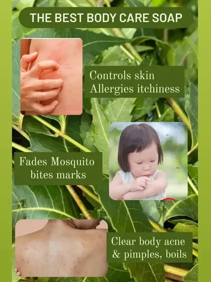 This soap is my go-to solution for body care. It helps control skin allergies and itchiness, fades mosquito bite marks, and clears body acne and boils.