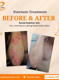 General & Procedural Dermatology