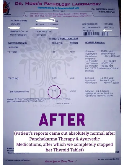 This is the "after" report for the same patient. Following a course of Panchakarma therapy and personalized Ayurvedic medications, their TSH level returned to a normal 3.27. We were then able to completely stop their thyroid tablet.