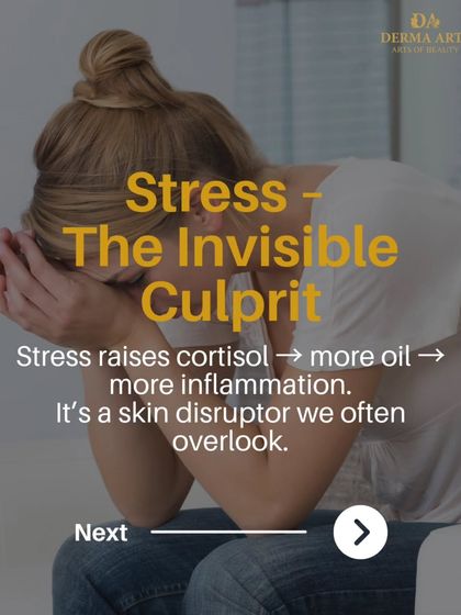 Stress is an invisible culprit. This image explains how stress raises cortisol, leading to more oil, more inflammation, and more breakouts.