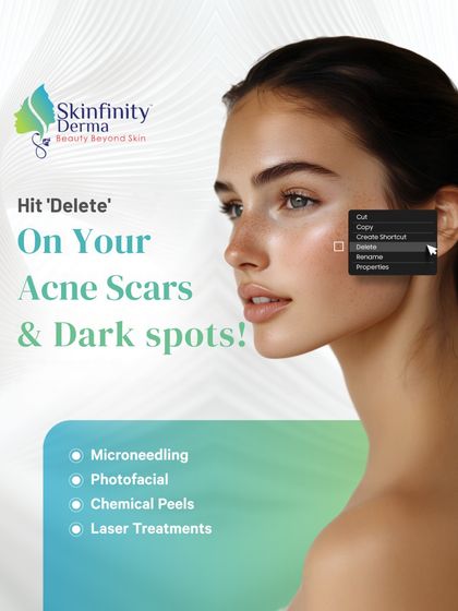 Hit 'delete' on acne scars and dark spots. We offer a range of advanced treatments including Microneedling, Photofacial, Chemical Peels, and Laser Treatments to help you achieve clear, blemish-free, and smooth skin.