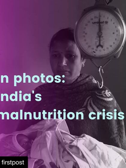 A promotional graphic for the photo series, featuring a mother holding her child next to a weighing scale. This visual was used to summarize the core theme of India's malnutrition crisis.