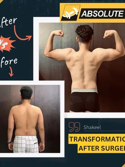 Shakeel's journey is a powerful reminder that no obstacle is too great. After undergoing surgery, he didn't make excuses; he found motivation. In just 6 months, he achieved this incredible body transformation, proving what's possible with resilience and the right support system.