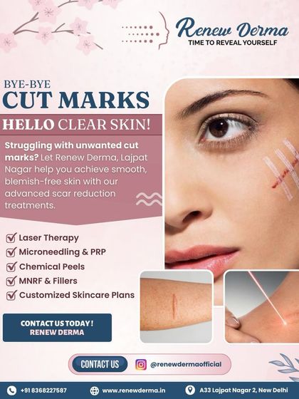 We offer a variety of advanced treatments for cut marks and other scars, including Laser Therapy, Microneedling, and MNRF, to help you achieve smooth, blemish-free skin.