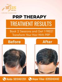 Hair Fall & Regrowth Treatment