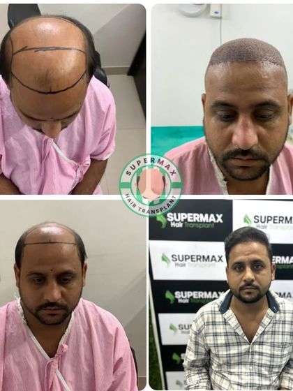 This 6-month result shows the complete journey. From planning to the final look, we are with you at every step.