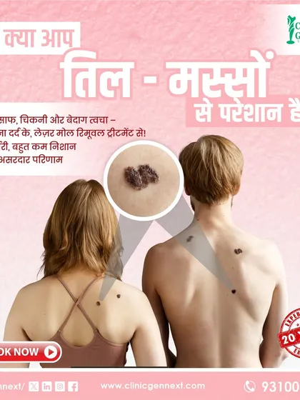 Many people are troubled by moles and warts, but trying home remedies can lead to scars and infections. I use an advanced laser procedure for removal, which is done without surgery or stitches, ensuring minimal to no scarring for clear, smooth skin.