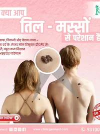 Mole & Wart Removal