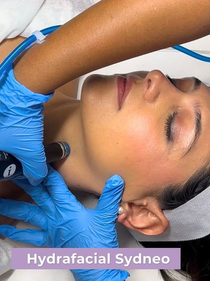 The HydraFacial Syndeo is a cornerstone of our pre-wedding prep. This image captures the treatment in progress, showcasing how we deliver deep hydration and an instant glow, making it a perfect facial before any major event.