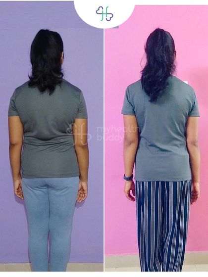 This client learned about Diastasis Recti after her pregnancy and decided to take action. In 12 weeks, she lost 6 kgs and significantly improved her core strength by focusing on portion control and targeted exercises.
