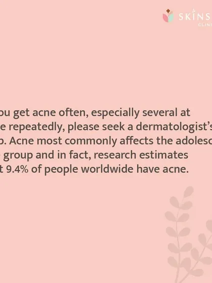 It is important to understand that acne is a common condition affecting millions, but you do not have to live with it. If you experience frequent breakouts, seeking a dermatologist's help is the first step toward effective management.