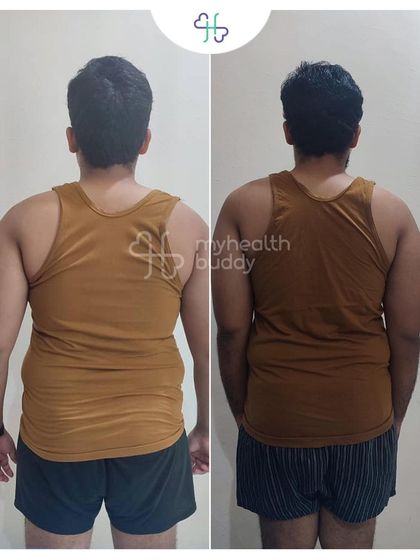 Gowtham's back transformation after 3 months, showing the clear path to a healthier physique.