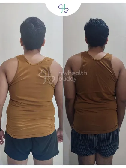 Gowtham's back transformation. Building a stronger back and core was a key part of his program, leading to better posture and overall strength.