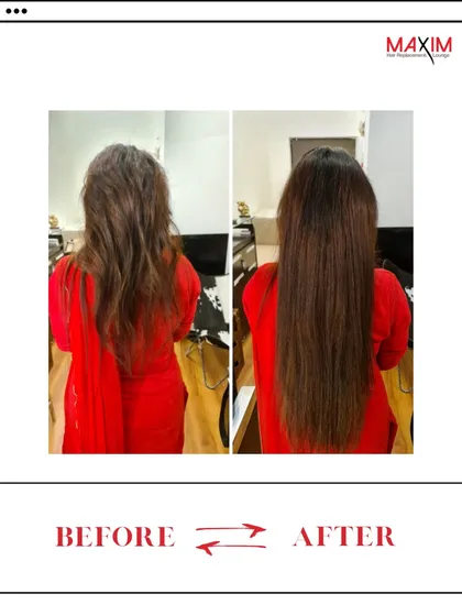 A classic transformation that adds both length and body. The 'after' result is sleek, straight hair that has movement and a healthy shine, thanks to high-quality extensions.