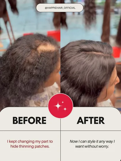 Constantly changing your parting to hide thinning patches can be exhausting. With a well-integrated topper, you can part your hair any way you want, without a second thought.