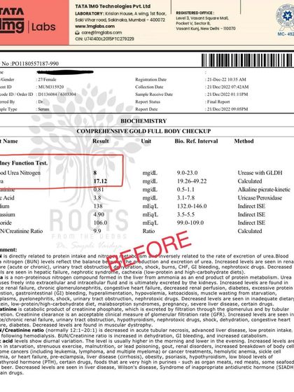 Before: The same patient also had abnormal kidney function tests, with elevated Urea and BUN levels, often linked to metabolic stress from thyroid issues.