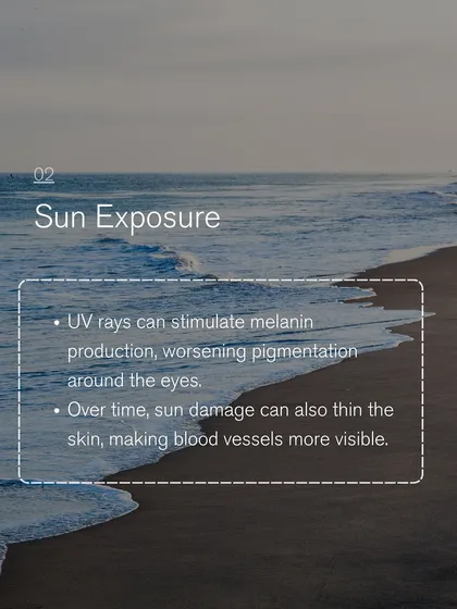 Sun exposure is a major cause of under-eye pigmentation. UV rays stimulate melanin production and can thin the skin over time, making blood vessels more visible.