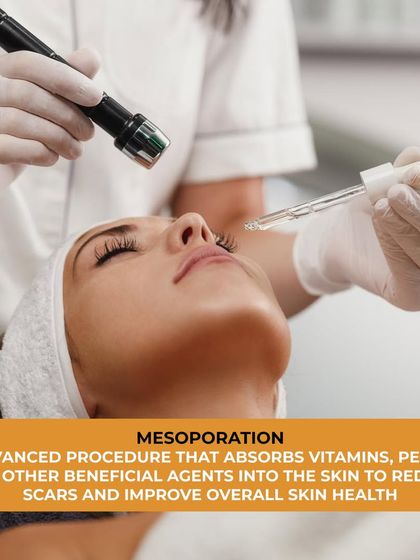 Mesoporation is an advanced procedure that enhances the skin's ability to absorb beneficial agents. We use this technique to deliver a cocktail of vitamins, peptides, and other nutrients deep into the skin to reduce scars and improve overall skin health.
