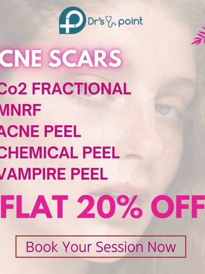 We offer a range of effective treatments for acne scars, including CO2 Fractional laser, MNRF, and various peels. Take advantage of our special offers to start your journey to clearer skin.