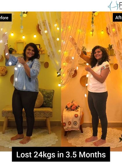 Shefali's journey is truly inspiring. She lost 24 kgs in 3.5 months, achieving a goal she had struggled with for over 10 years. Her dedication combined with our method delivered incredible results.