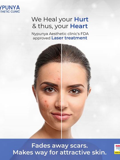 This before-and-after shows the transformative results of our FDA-approved laser treatments. By precisely targeting scars and damaged tissue, we can fade away imperfections and make way for smoother, more attractive skin.