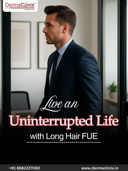 Live an uninterrupted life with Long Hair FUE. This procedure is designed for those who want a hair restoration solution without the awkward stages of shaving and regrowth.