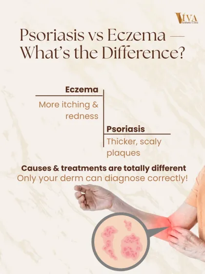 Is it psoriasis or eczema? While both can be itchy, psoriasis plaques are typically thicker and more scaly. This graphic highlights the visual differences, but only a dermatologist can diagnose your condition correctly as the causes and treatments are completely different.