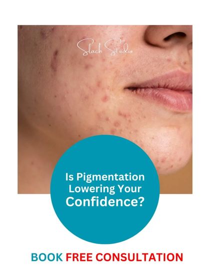 If pigmentation is lowering your confidence, I'm here to help. Book a free consultation to discuss a personalized treatment plan.