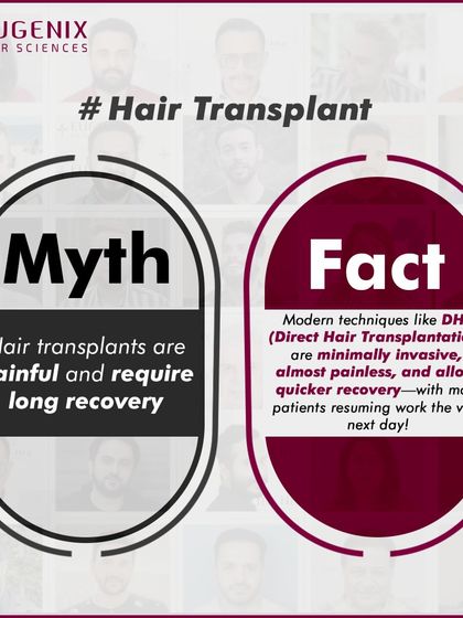 We tackle the biggest myths head-on: hair transplants are painful, only for celebrities, look fake, are dangerous, or are better done abroad.