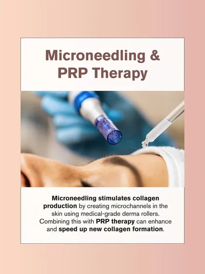 Microneedling with PRP is another powerful combination for treating acne scars. It uses medical-grade derma rollers to stimulate collagen, with PRP speeding up the healing process.